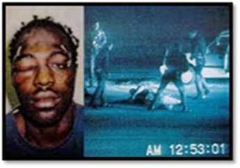 Rodney King and Police Assault