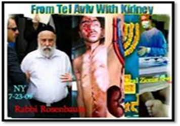 From Israel with Kidney