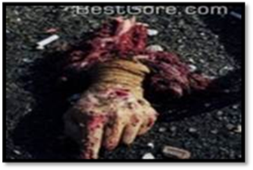 WTC dead hand